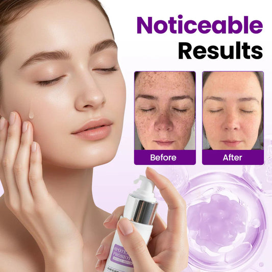 NESLEMY® SpotErase Probiotic Shield Serum