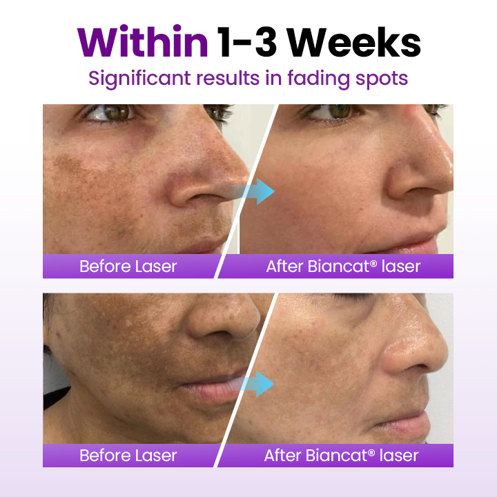 NESLEMY® SpotErase Probiotic Shield Serum