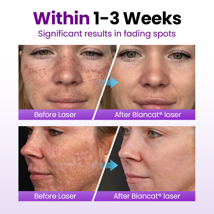 NESLEMY® SpotErase Probiotic Shield Serum