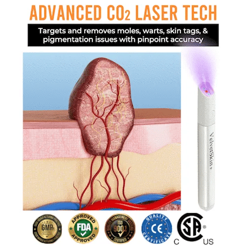 🔬qiawi™ All-in-one Co₂ Laser Eraser Pen | Removes Moles, Warts, Skin Flaws & Pigmentation