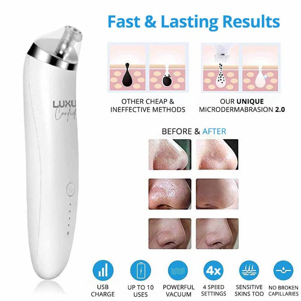 Aphrodite - Blackheads Treatment Kit 2.0