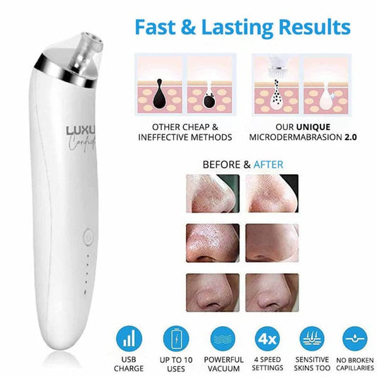 Aphrodite - Blackheads Treatment Kit 2.0